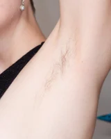 We Are Hairy - 15-0015